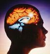 Imagen cerebro